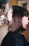 Client before; with alopecia aerate at the back-half of her head; profile